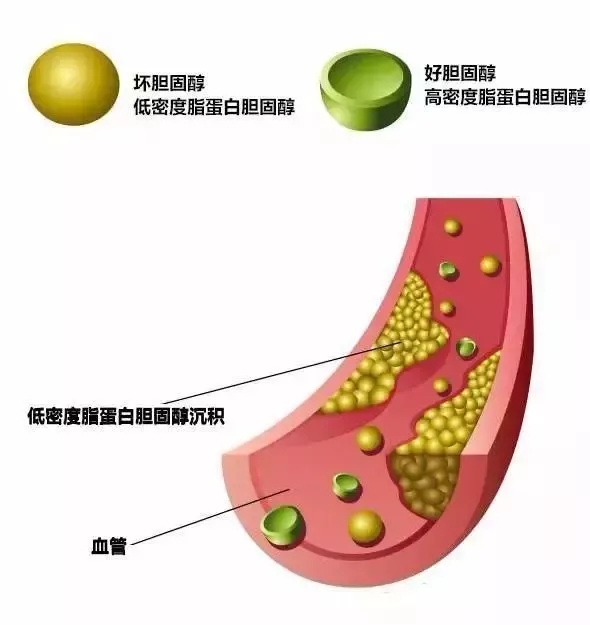 37mmol/l就会被诊断为高低密度脂蛋白胆固醇升高.